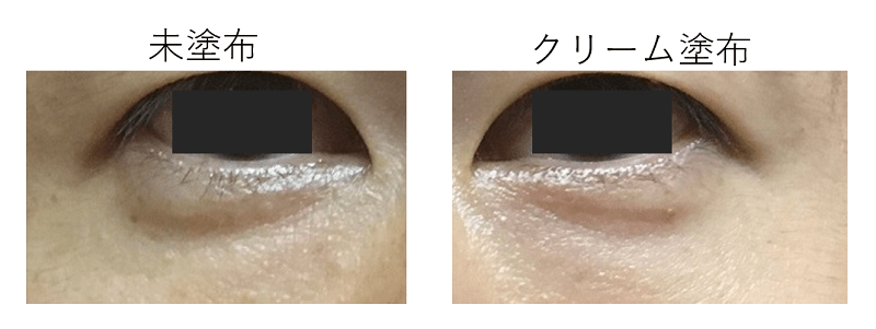 クリーム使用比較