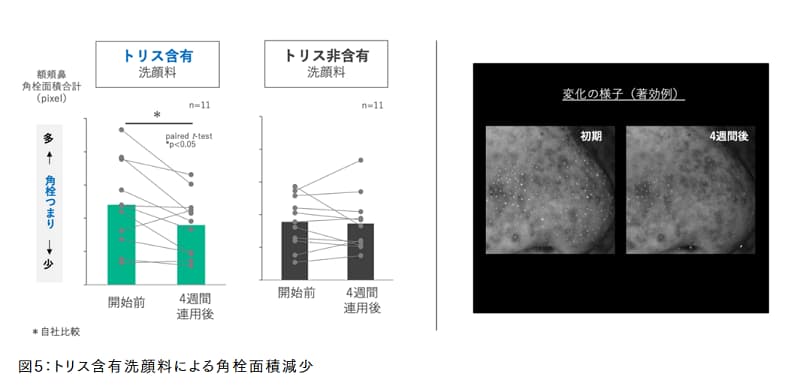 tトリス洗浄料の効果