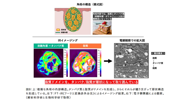 角栓情報