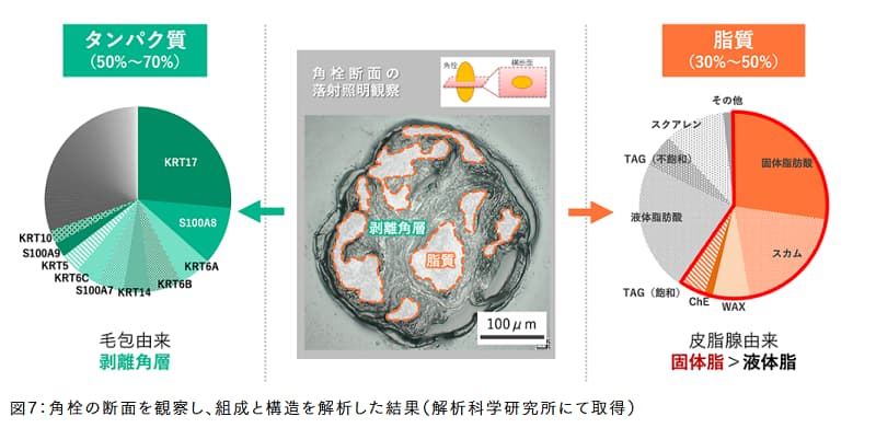 角栓組成
