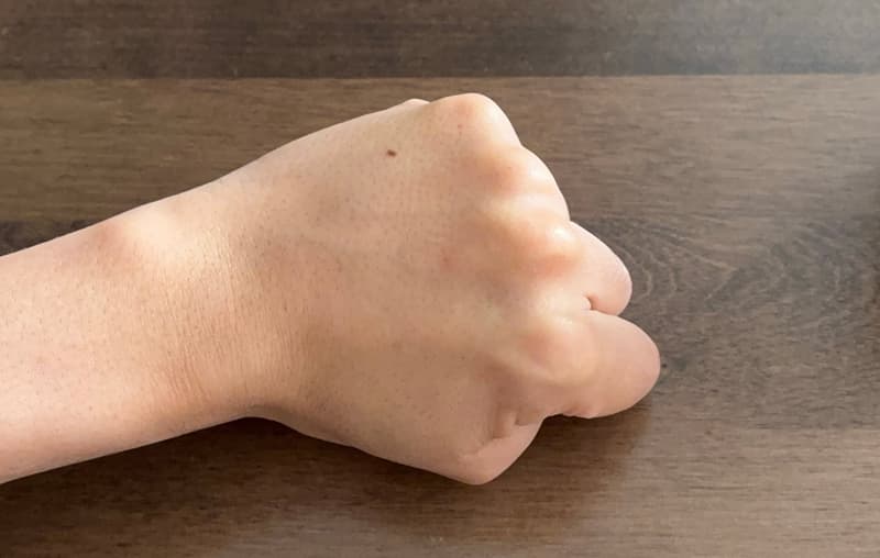 ザセラム馴染み後