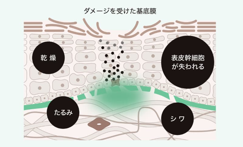 ダメージを受けた基底膜