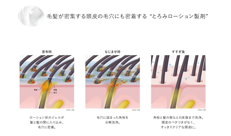 角栓除去技術